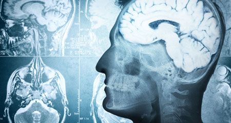 Differences in Human and Neanderthal Brains Explain Human Exceptionalism