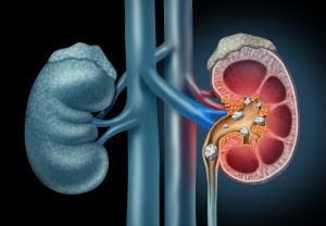 blog__inline--pseudogene-discovery-pains-1 blog__inline--pseudogene-discovery-pains-1